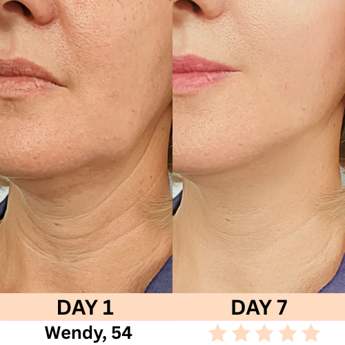 Restless™ 7-in-1 Facial Wand