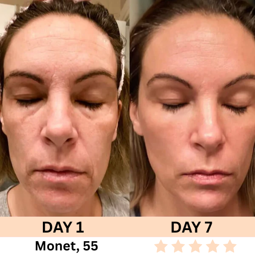 Restless™ 7-in-1 Facial Wand