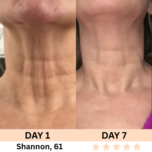 Restless™ 7-in-1 Facial Wand