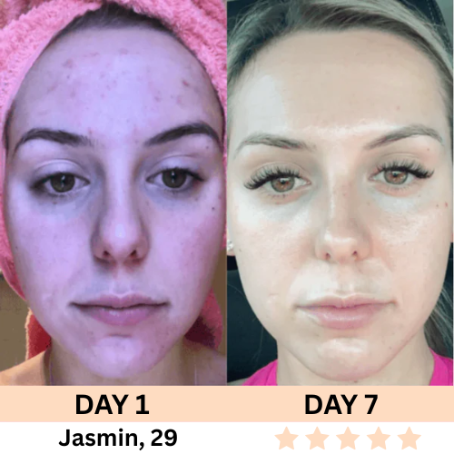 Restless™ 7-in-1 Facial Wand