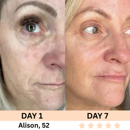 Restless™ 7-in-1 Facial Wand