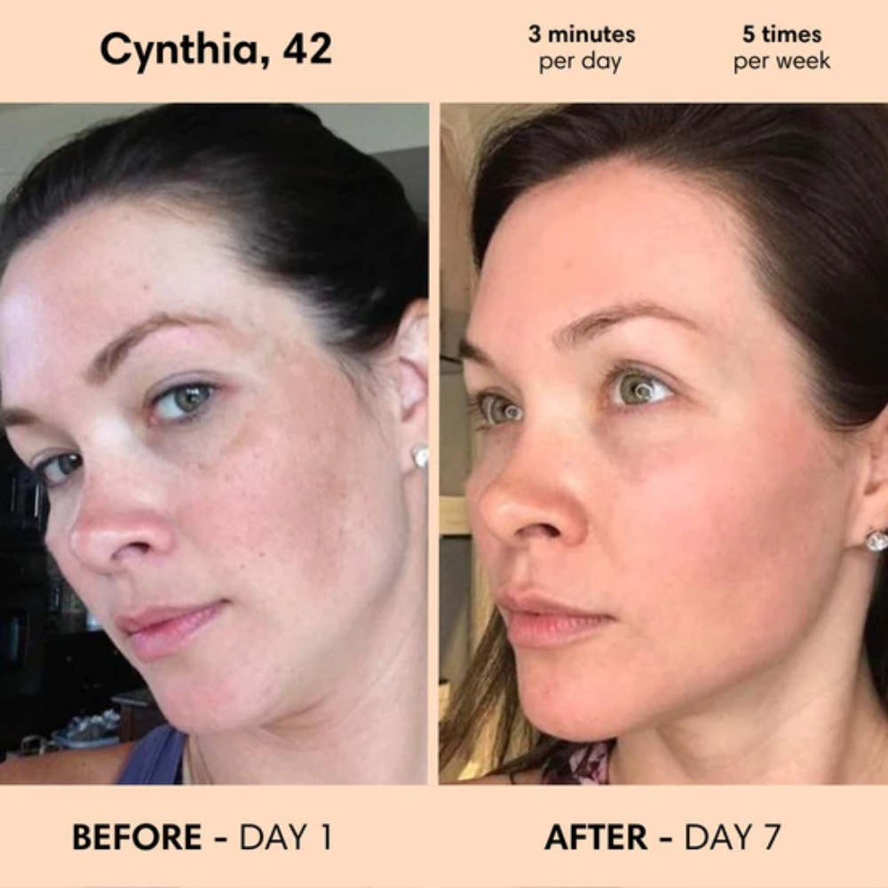 Restless™ 7-in-1 Facial Wand