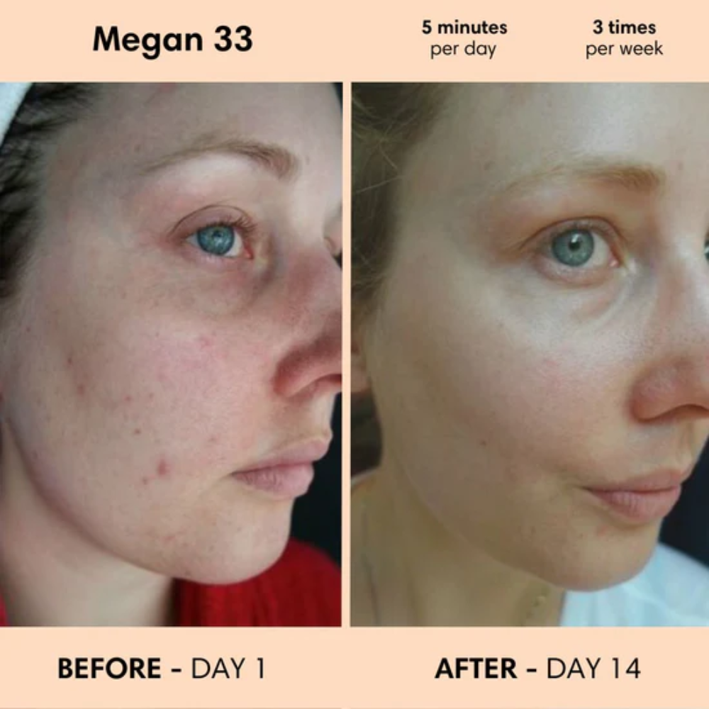 Restless™ 7-in-1 Facial Wand